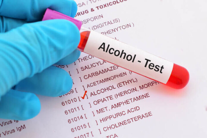 Drug Testing Programs & Services for Employment