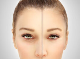 Blepharoplasty: Opening The Eyes To A Brighter Visual Future Blepharoplasty: Opening The Eyes To A Brighter Visual Future