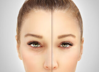 Blepharoplasty: Opening The Eyes To A Brighter Visual Future Blepharoplasty: Opening The Eyes To A Brighter Visual Future